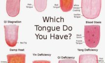 Tongue Diagnosis at Edmonton, AB