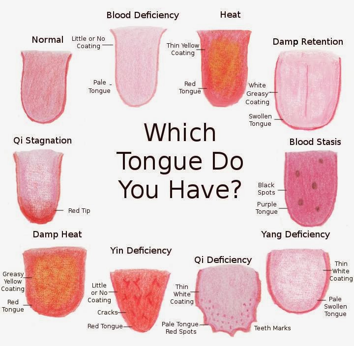 Tongue Diagnosis at Edmonton, AB