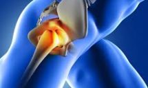 News on Hip Joint Pain Women by All Deep Massage & Wellness Clinic