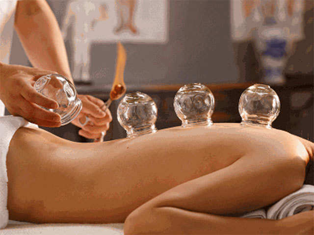 Cupping Massage Therapy in Sherwood Park, AB