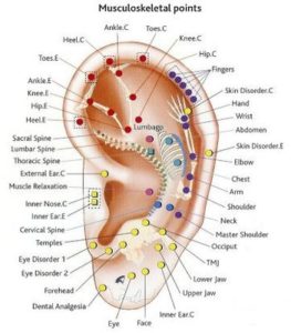 Auricular Acupuncture in Sherwood Park, AB