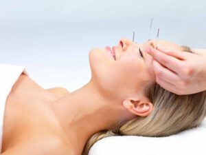 Cosmetic Acupuncture