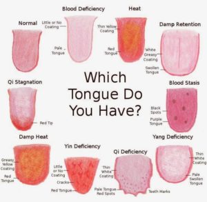 Tongue Diagnosis in Sherwood Park, AB