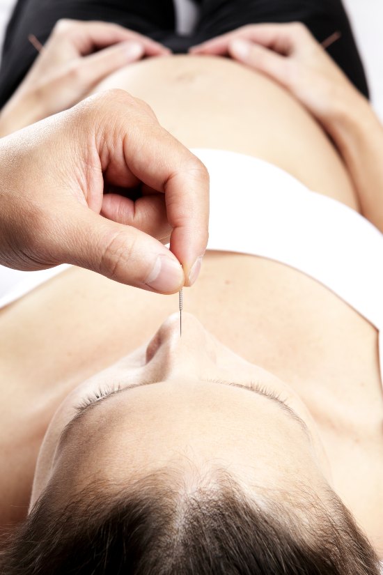 Acupuncture for Fertility