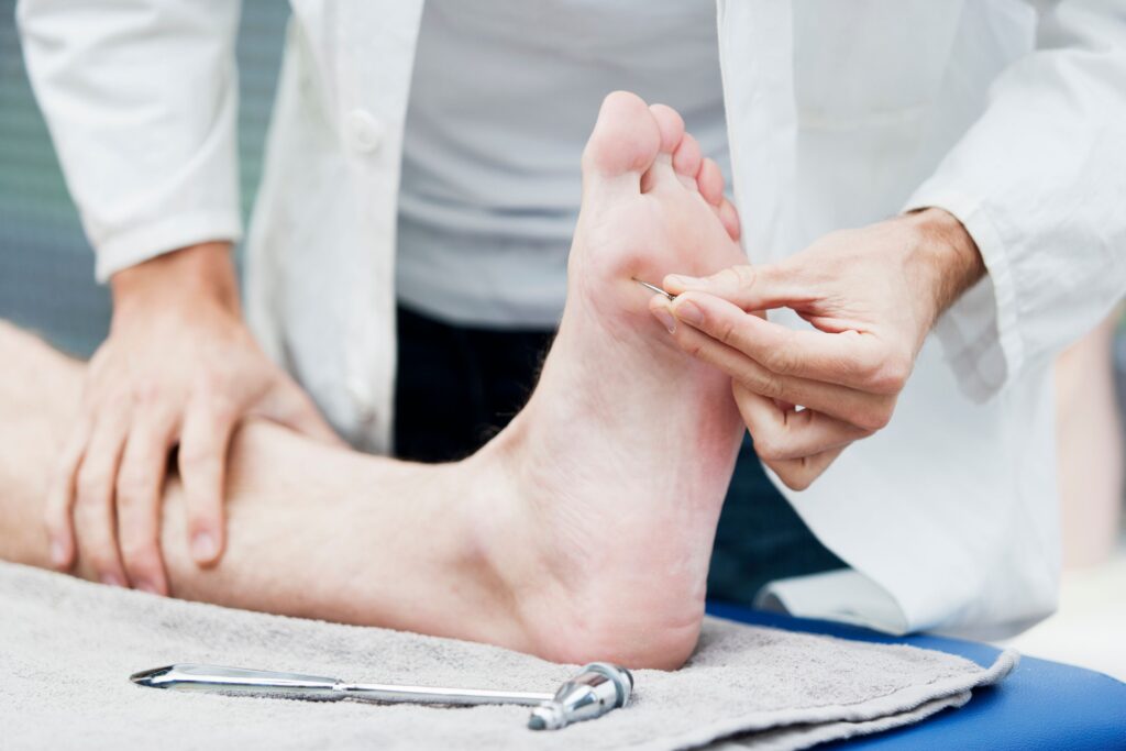 Doctor Testing Sensibility of Foot in Sherwood Park, AB 