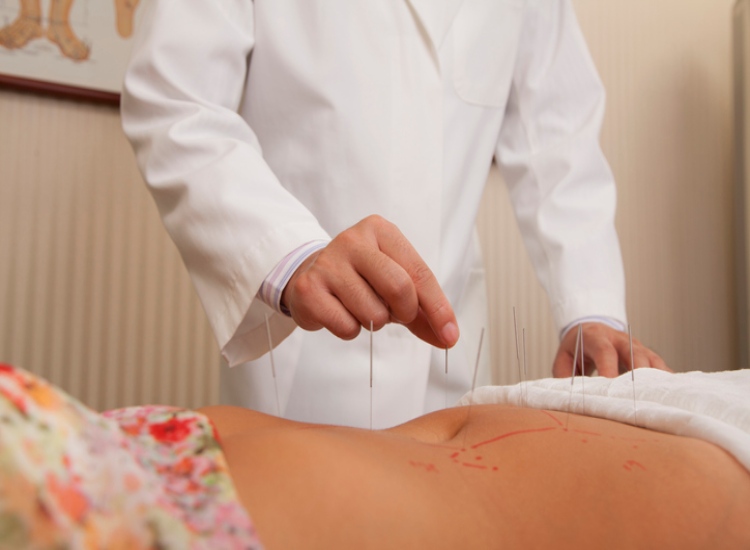 Acupuncture for Constipation Relief in Sherwood Park, AB