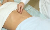 Acupuncture for Weight Loss in Sherwood Park, AB