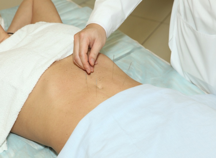 Acupuncture for Weight Loss in Sherwood Park, AB