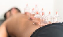Benefits of Cupping Therapy in Sherwood Park, AB