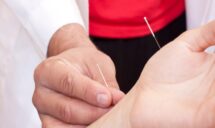 Acupuncture To Treat Raynaud's Syndrome in Sherwood Park, AB