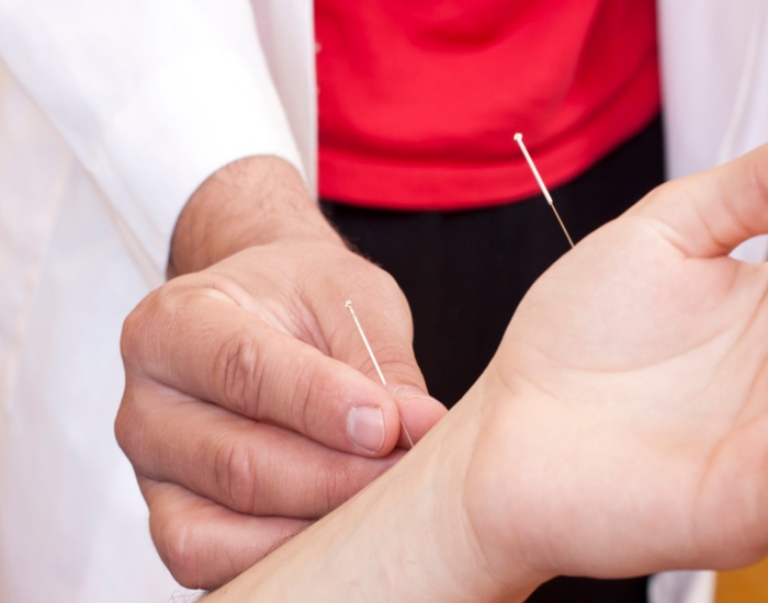 Acupuncture To Treat Raynaud's Syndrome in Sherwood Park, AB
