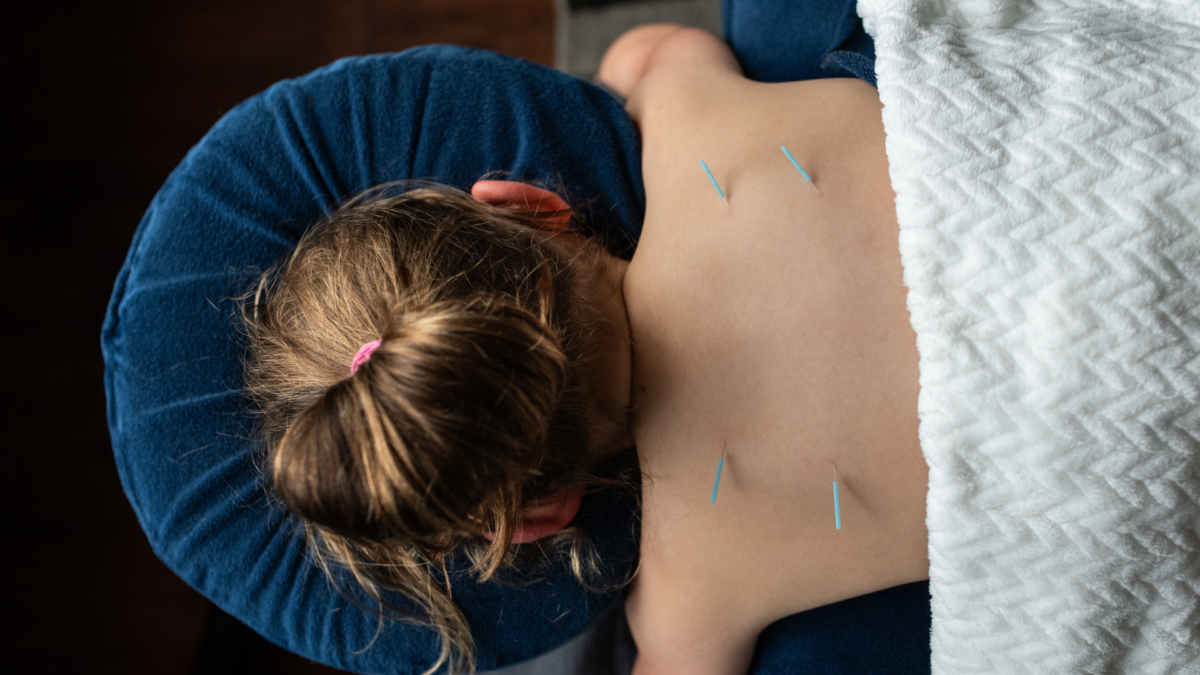 Acupuncture for Children Sherwood Park